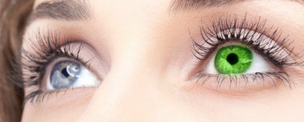 Гетерохромия – феномен разноцветных глаз