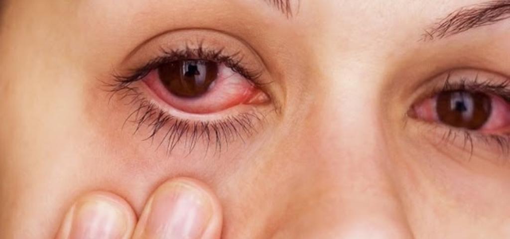 Линзы натерли глаза лечение