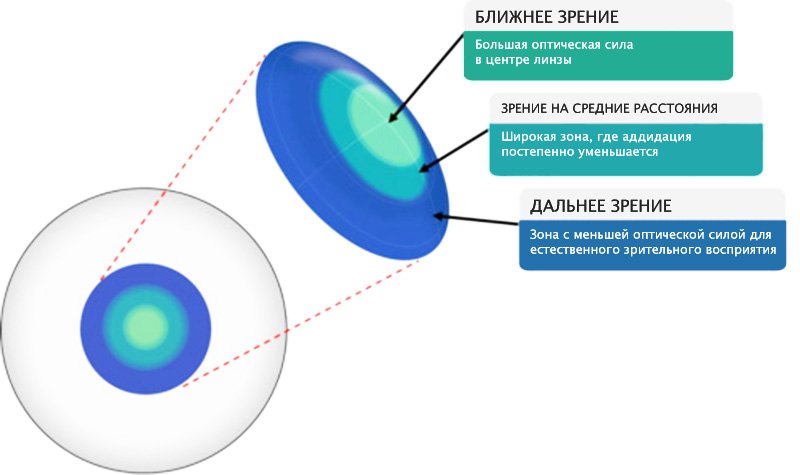Асферические контактные линзы – в чем их преимущество :: Публикации